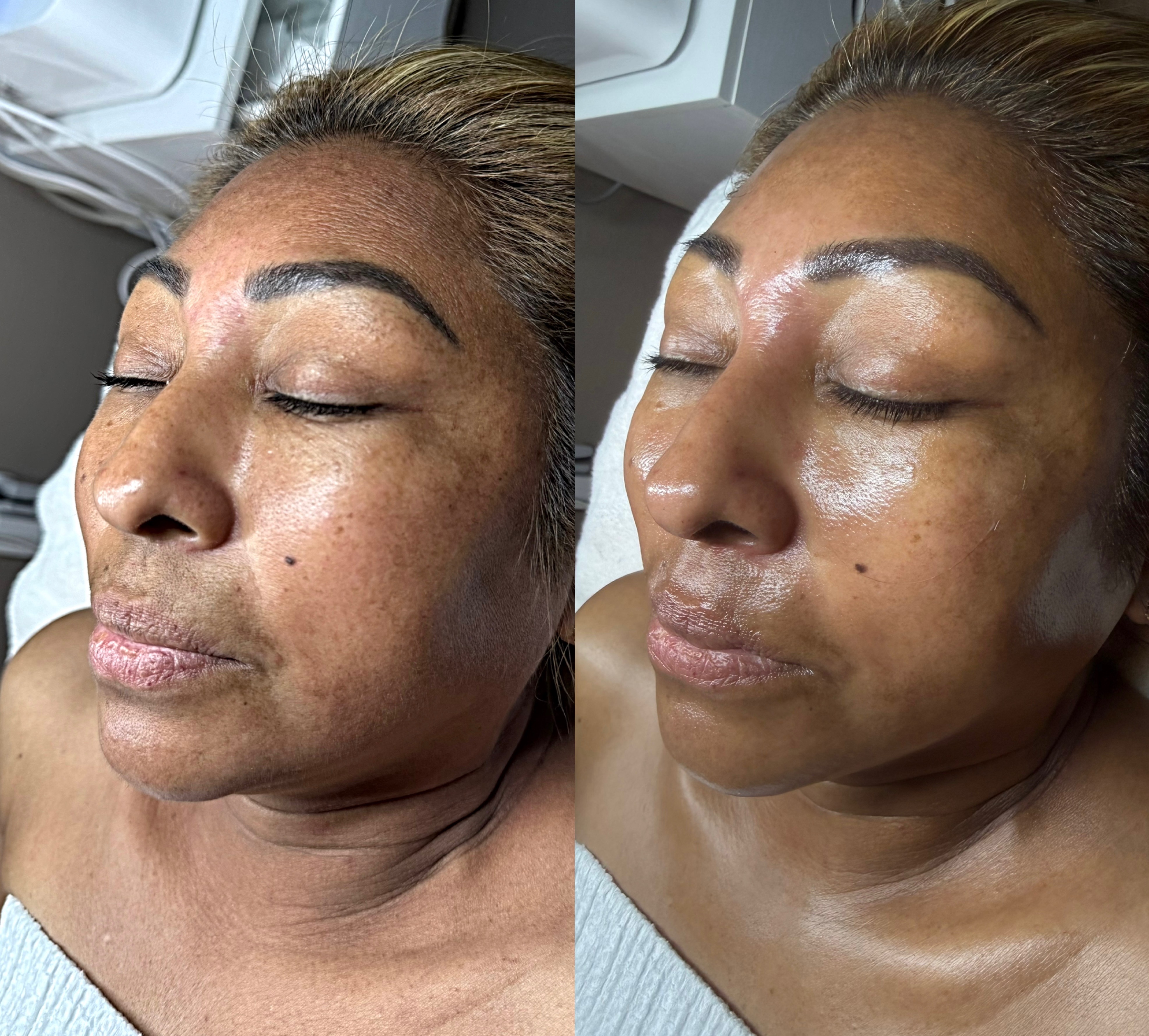Hydration and glow before and after